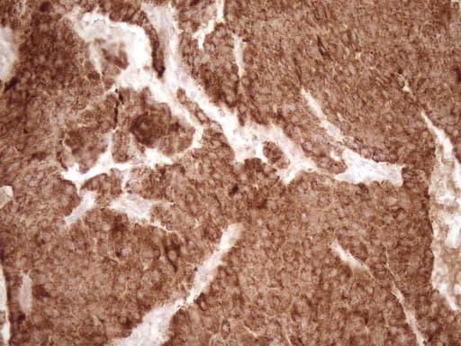Monoclonal Mouse anti-Human MMP3 Antibody (clone OTI1E9, aa246-477, IHC, WB)