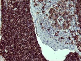 CD45 / LCA Antibody (clone OTI3D1)