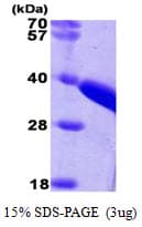 Human Rhodanese / TST Protein (Recombinant His)