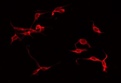 Polyclonal Rabbit anti-Human p56lck / LCK Antibody (phospho-Tyr505, IHC, IF, WB)