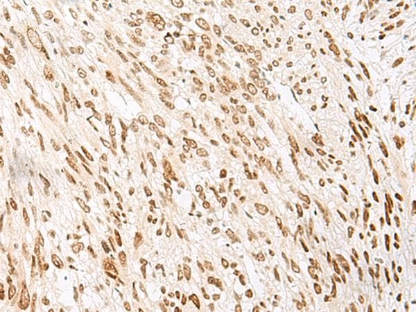 NOLA2 Antibody