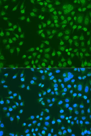 Polyclonal Rabbit anti-Human KAT5 / TIP60 Antibody (IHC, IF, WB)