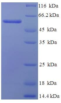 Human PABPC1 / PABP1 Protein (Recombinant His-SUMO)