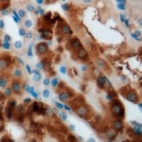 Polyclonal Rabbit anti-Human CBS Antibody (IHC, IF, WB)