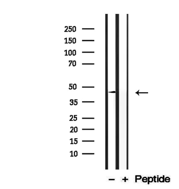 Polyclonal Rabbit anti-Human DXO / DOM3Z Antibody (IHC, WB)