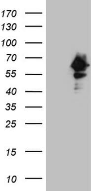 RAB3IP / RABIN3 Antibody (clone OTI5H1, Carrier-free)