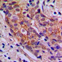 PI3K Alpha+Gamma Antibody (Internal)