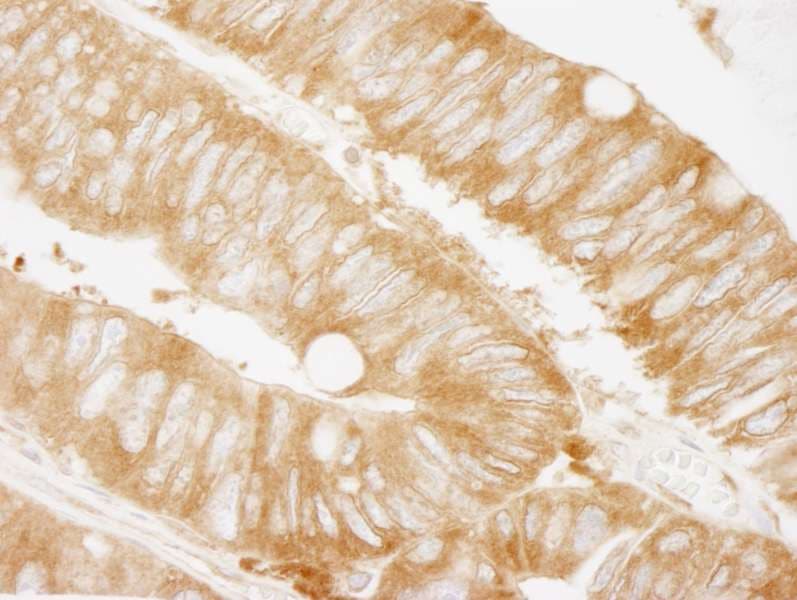 KARS Antibody (aa550-C-term)