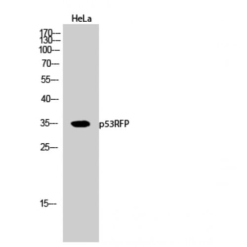 RNF144B Antibody (Internal)