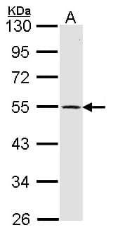DRD1 / Dopamine Receptor D1 Antibody