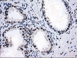 Monoclonal Mouse anti-Human L1CAM Antibody (clone OTI4F4, IHC, IF, WB)