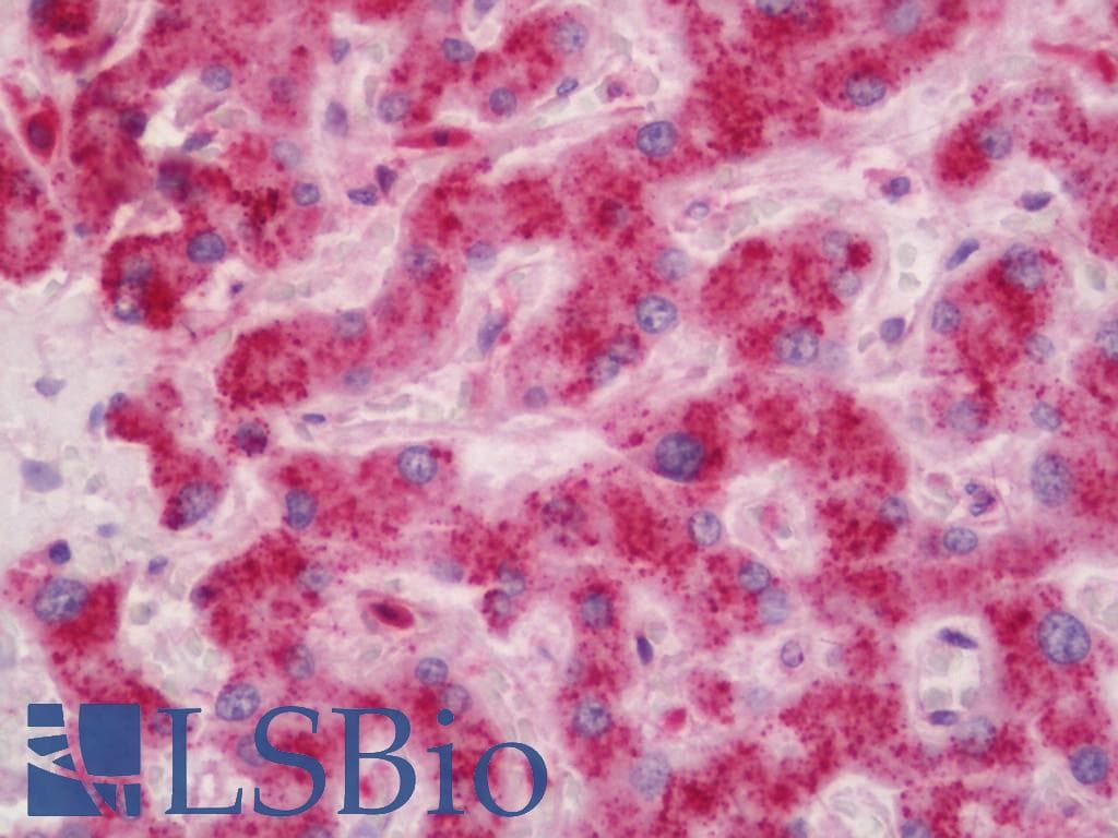 IHC-plus™ ARHGEF12 Antibody (aa435-484)