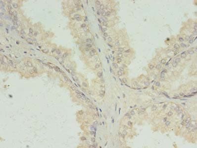 PRKRA / PACT Antibody