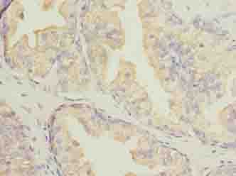 Polyclonal Rabbit anti-Human DNALI1 Antibody (IHC, WB)