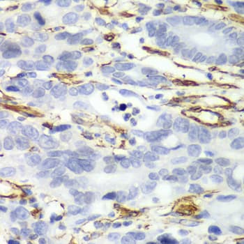 Polyclonal Rabbit anti-Human CALD1 / Caldesmon Antibody (IHC, IF, WB)