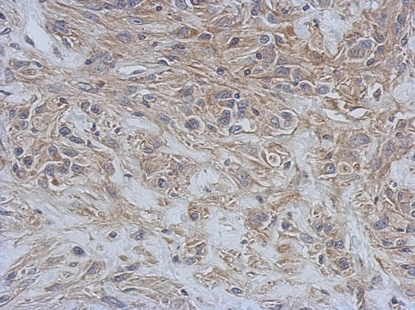 RAP1GDS1 / SmgGDS Antibody (N-Terminus)