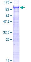 Human ST7L Protein (Recombinant GST)