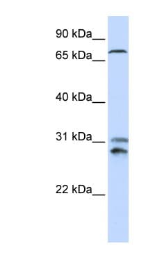 TLK2 Antibody (aa176-225)