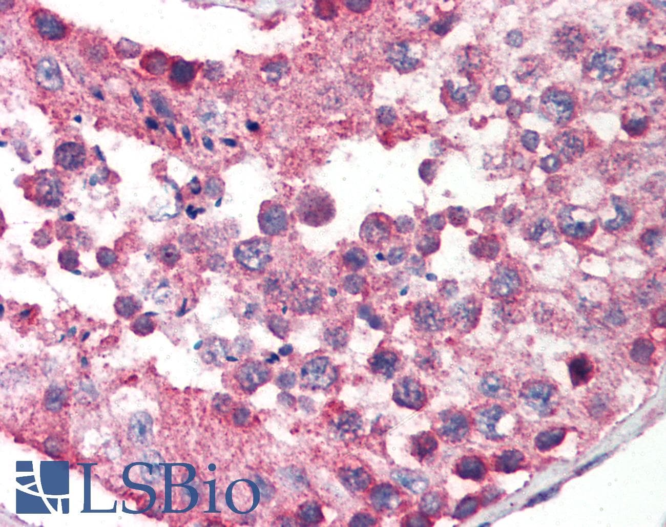 IHC-plus™ Polyclonal Rabbit anti-Human IKBKAP / IKAP Antibody (IHC, IF, WB)