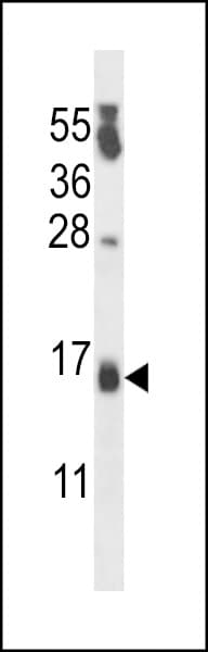 Polyclonal Rabbit anti-Human CSDC2 Antibody (aa76-105, IHC, WB)