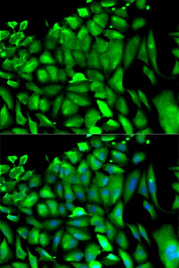 PGK1 / Phosphoglycerate Kinase Antibody
