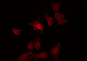 KCNK4 / TRAAK Antibody