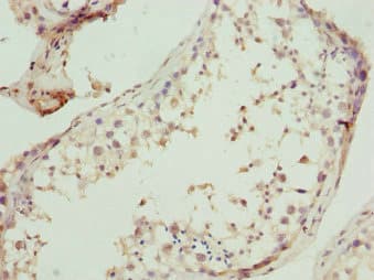 UBA3 / UBE1C Antibody