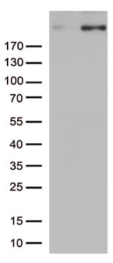 Monoclonal Mouse anti-Human CAD Antibody (clone OTI1A7, Carrier-free, aa1918-2225, WB)