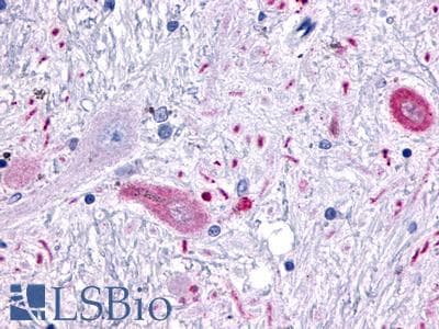 PathPlus™ Polyclonal Rabbit anti-Human MCHR2 Antibody (Cytoplasmic Domain, IHC)