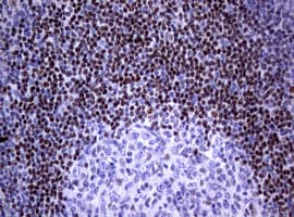 Monoclonal Mouse anti-Human FOXP1 Antibody (clone OTI3G3, IHC)