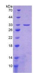 Mouse ITGA1/CD49a/Integrin Alpha 1 Protein (Recombinant His-T7)