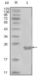 CD105 Antibody (clone 3G9D10)
