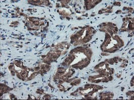 Monoclonal Mouse anti-Human SKIL / SNO / SnoN Antibody (clone OTI3E2, IHC, WB)