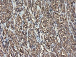 PHF7 Antibody (clone OTI1G9)