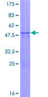 Human VHL / Von Hippel Lindau Protein (Recombinant GST, N-terminus)