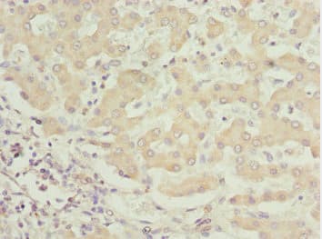 Polyclonal Rabbit anti-Human BNIP1 Antibody (IHC)