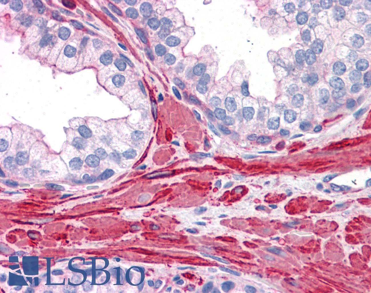 IHC-plus™ Polyclonal Rabbit anti-Human FLNA / Filamin A Antibody (IHC, IF, WB)
