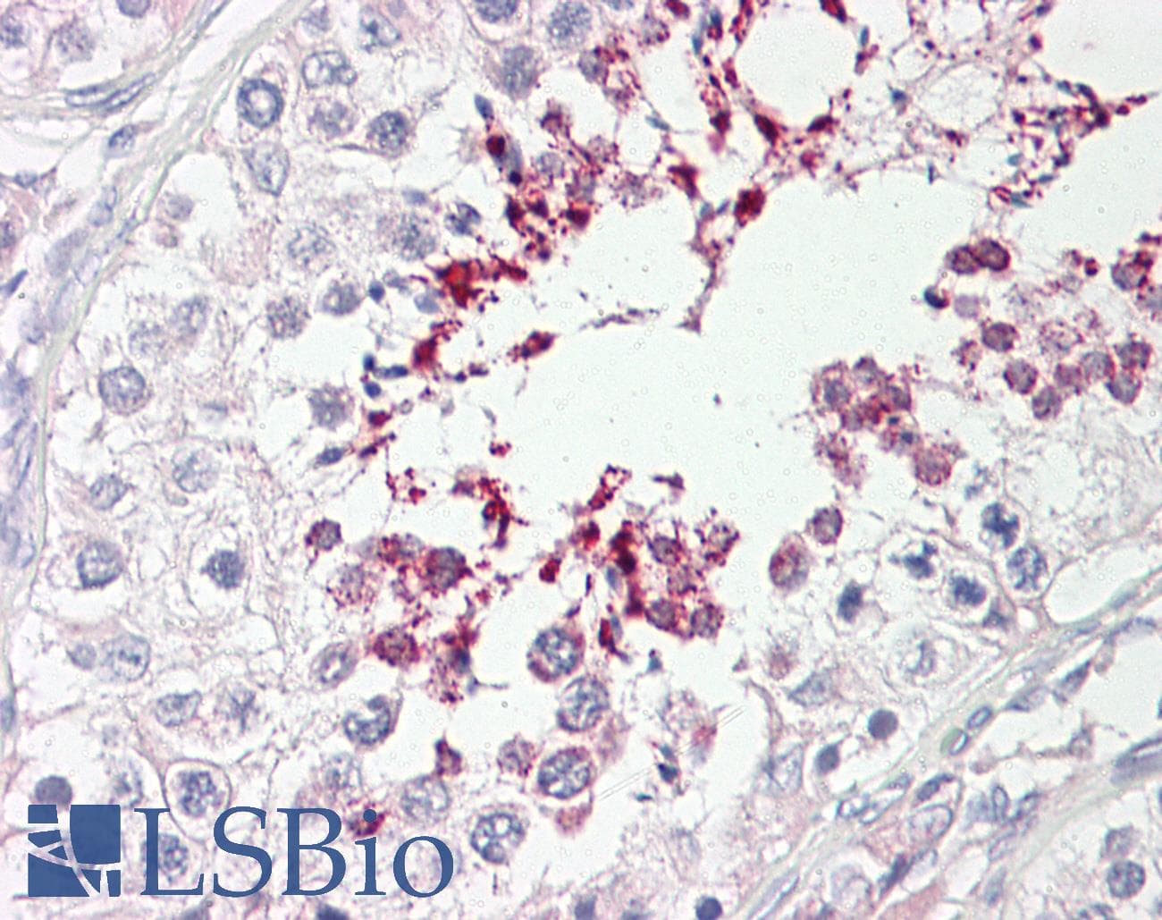 Polyclonal Rabbit anti-Human ATP10D Antibody (FITC, aa1154-1203, IHC, WB)