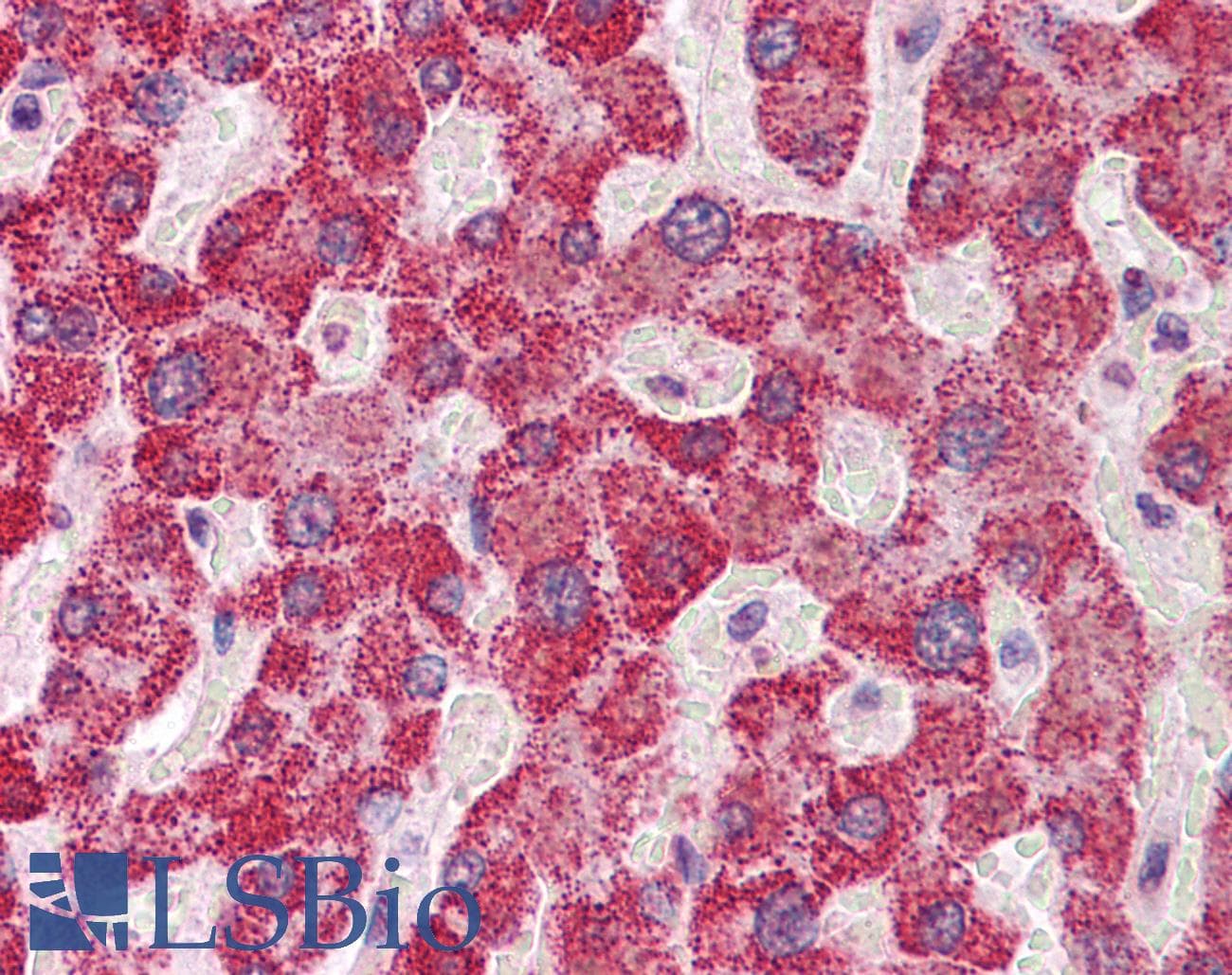 Polyclonal Rabbit anti-Human SH2B1 Antibody (aa395-444, IHC, WB)