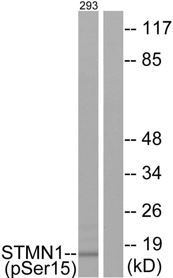 Polyclonal Rabbit anti-Human STMN1 / Stathmin / LAG Antibody (phospho-Ser15, IHC, IF, WB)