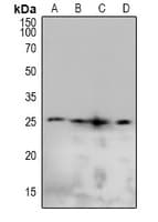 CAV2 / Caveolin 2 Antibody