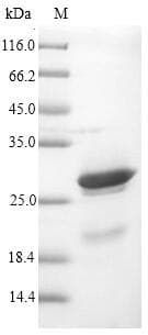 Vaccinia Virus K3L/VACWR034 Protein (Recombinant 6His-SUMO, N-terminus)