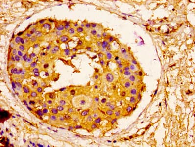 ORM1 / Orosomucoid Antibody