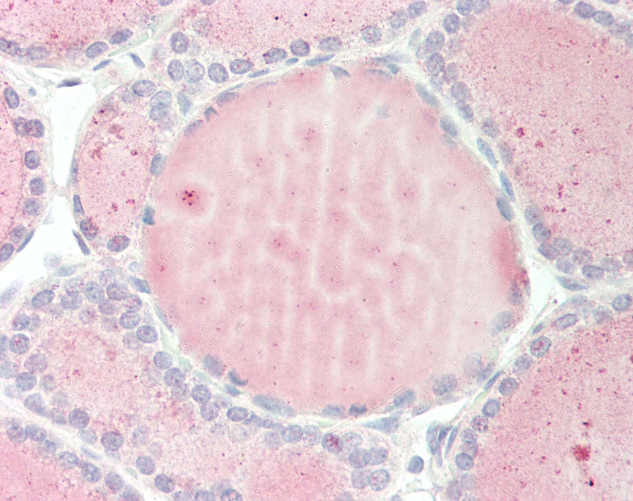 RPS3A / Ribosomal Protein S3A Antibody (aa35-84)