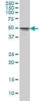 IHC-plus™ MKNK1 / MNK1 Antibody (clone 2H8)