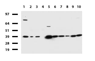 Monoclonal Mouse anti-Human HMBS / PBGD Antibody (clone UMAB144, Carrier-free, IHC, IF, WB)