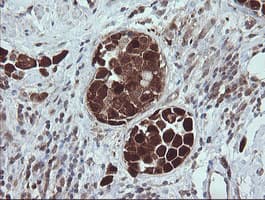 Monoclonal Mouse anti-Human TRIM44 Antibody (clone OTI1E10, IHC, IF, WB)