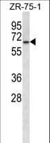 Polyclonal Rabbit anti-Human GPD2 Antibody (aa606-634, IHC, WB)