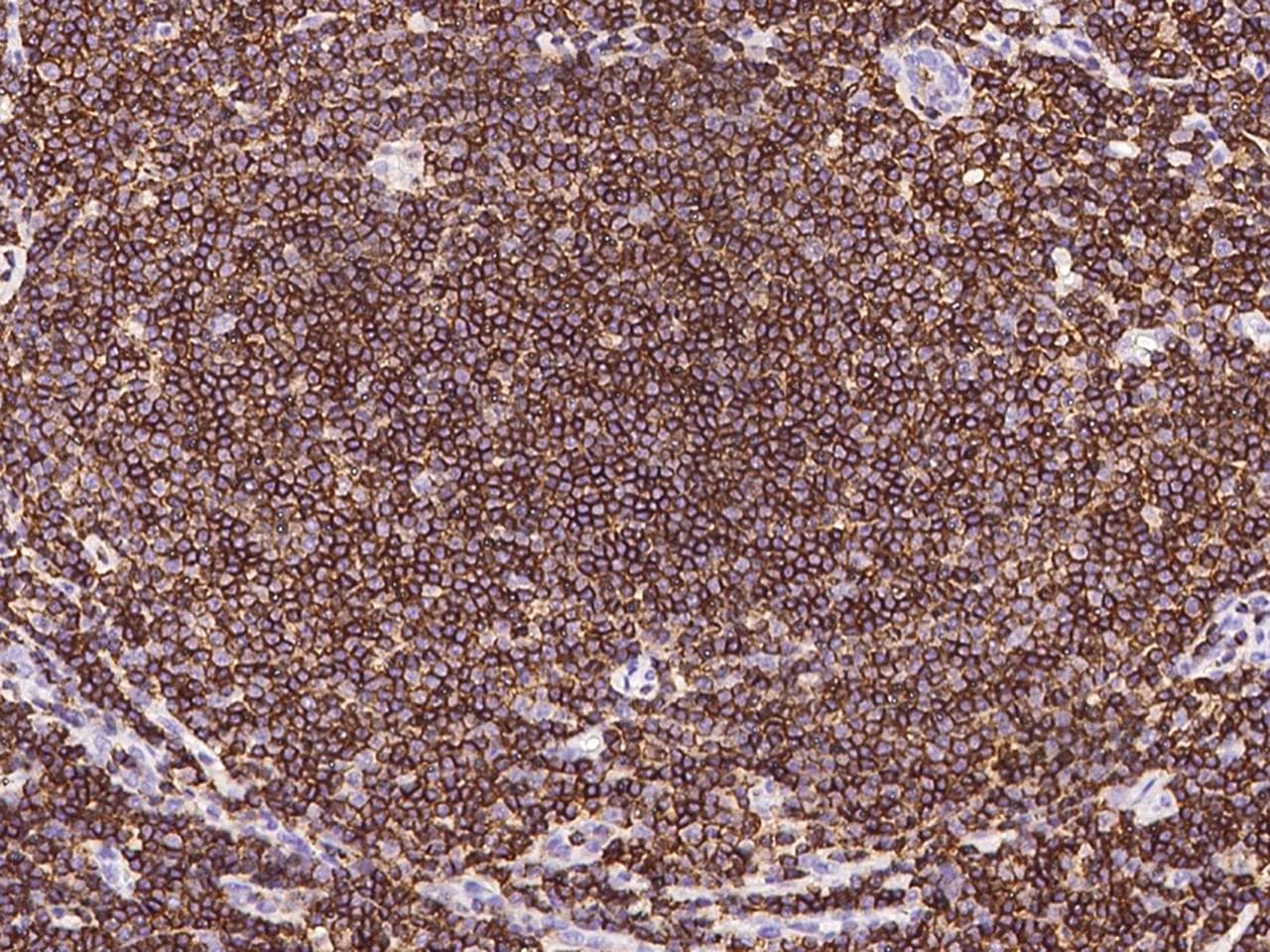 Monoclonal Mouse anti-Human CD45 / LCA Antibody (clone 20, Preservative Free, IHC, WB)