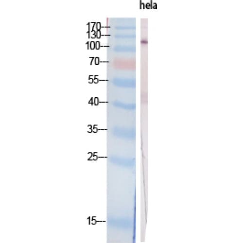 PIK3CA / PI3K Alpha Antibody (Internal)